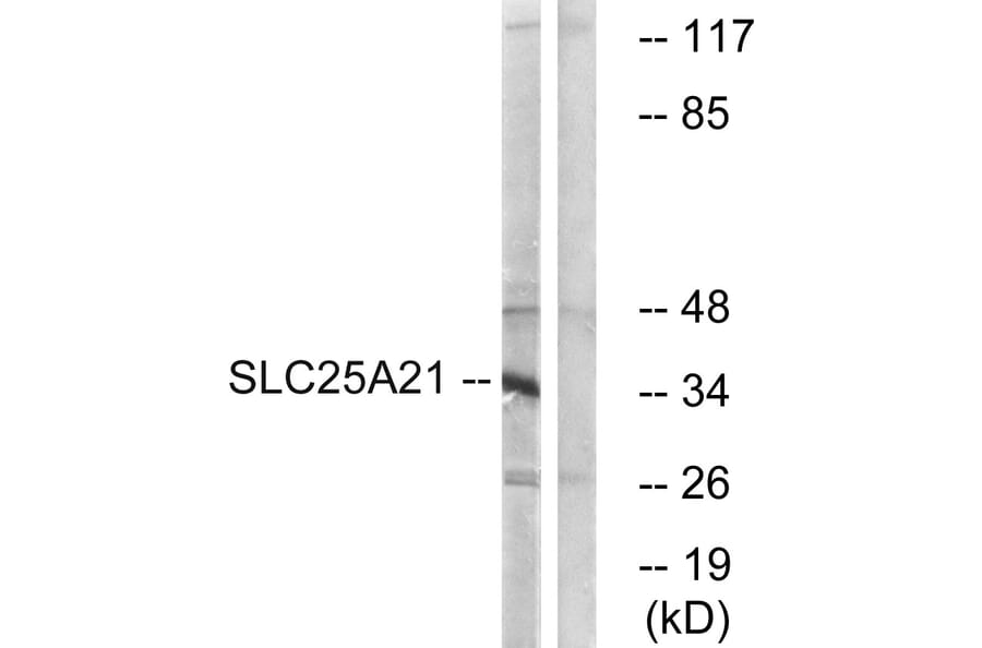 Western Blot - Anti-SLC25A21 Antibody (C16666) - Antibodies.com