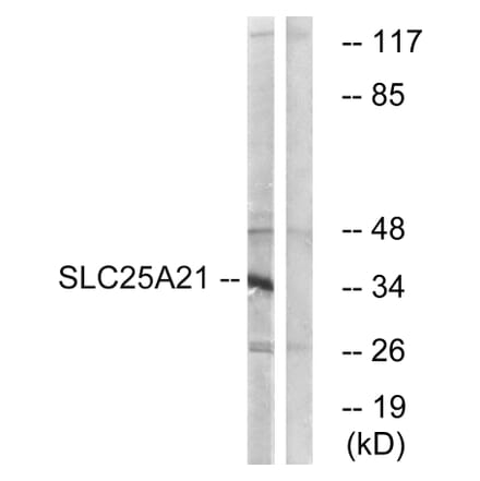 Western Blot - Anti-SLC25A21 Antibody (C16666) - Antibodies.com