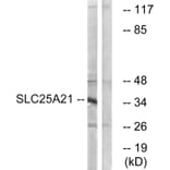 Western Blot - Anti-SLC25A21 Antibody (C16666) - Antibodies.com