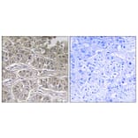 Immunohistochemistry - Anti-SLC25A21 Antibody (C16666) - Antibodies.com