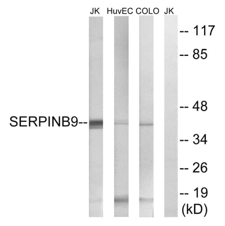 Western Blot - Anti-SERPINB9 Antibody (C18685) - Antibodies.com