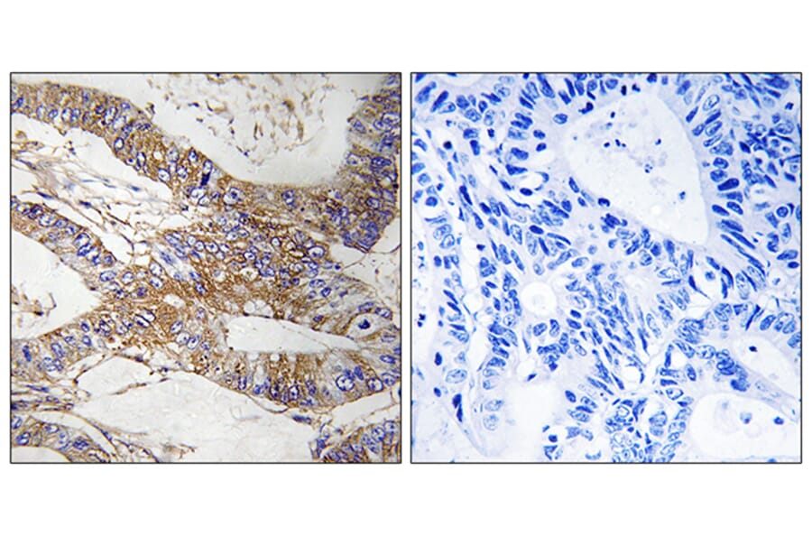 Immunohistochemistry - Anti-SERPINB9 Antibody (C18685) - Antibodies.com