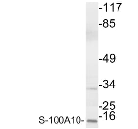 Western Blot - Anti-S-100A10 Antibody (R12-2342) - Antibodies.com