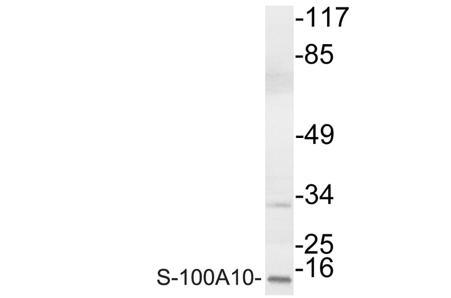 Western Blot - Anti-S-100A10 Antibody (R12-2342) - Antibodies.com