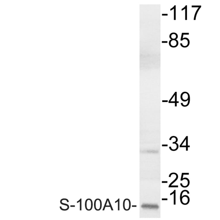 Western Blot - Anti-S-100A10 Antibody (R12-2342) - Antibodies.com