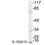 Western Blot - Anti-S-100A10 Antibody (R12-2342) - Antibodies.com