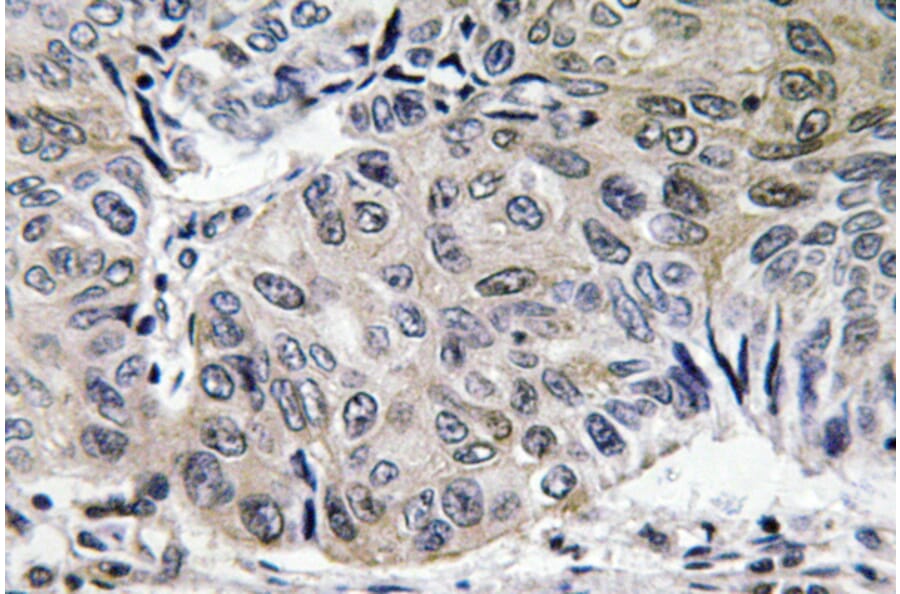 Immunohistochemistry - Anti-S-100A10 Antibody (R12-2342) - Antibodies.com