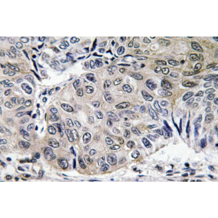 Immunohistochemistry - Anti-S-100A10 Antibody (R12-2342) - Antibodies.com