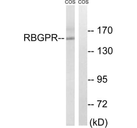 Western Blot - Anti-RAB3GAP2 Antibody (C18125) - Antibodies.com