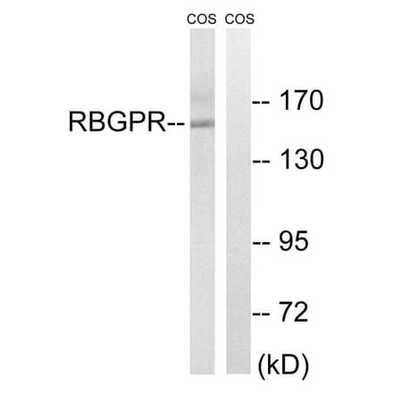 Western Blot - Anti-RAB3GAP2 Antibody (C18125) - Antibodies.com