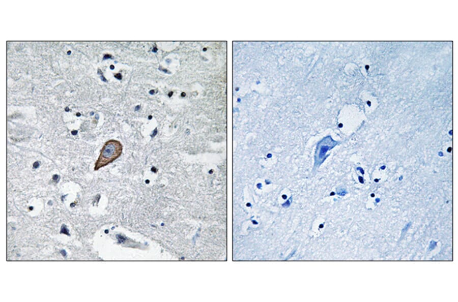 Immunohistochemistry - Anti-PKC thet Antibody (B0719) - Antibodies.com