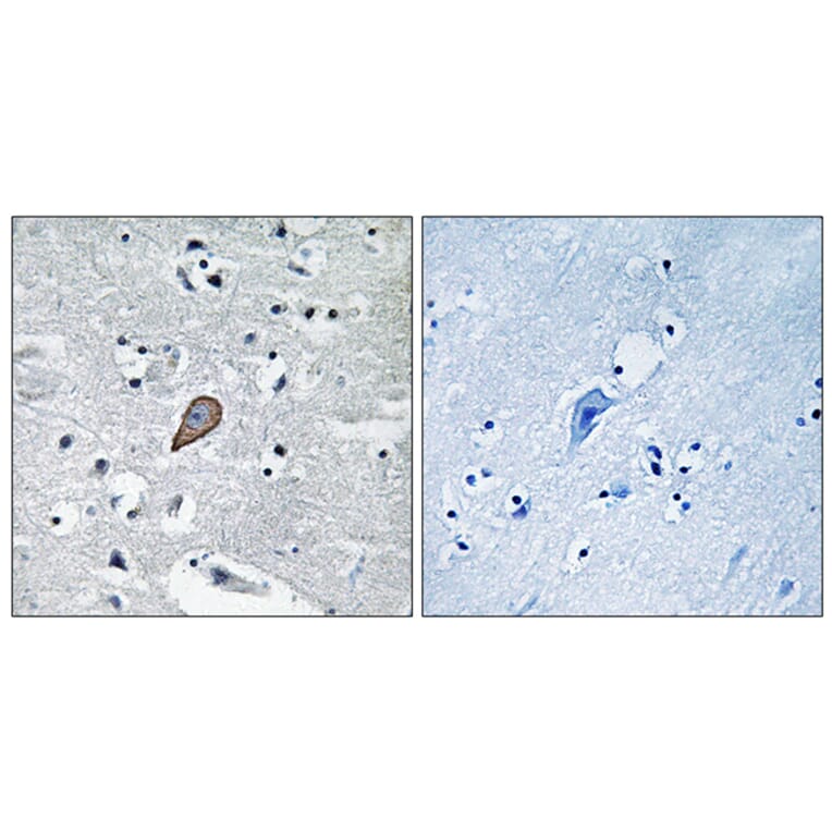 Immunohistochemistry - Anti-PKC thet Antibody (B0719) - Antibodies.com