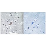 Immunohistochemistry - Anti-PKC thet Antibody (B0719) - Antibodies.com