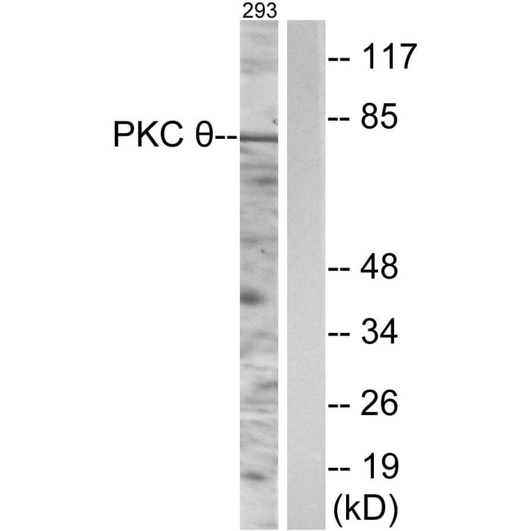 Western Blot - Anti-PKC thet Antibody (B0719) - Antibodies.com