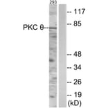 Western Blot - Anti-PKC thet Antibody (B0719) - Antibodies.com