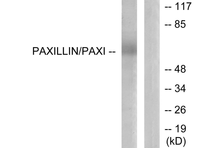 Western Blot - Anti-Paxillin Antibody (B7192) - Antibodies.com
