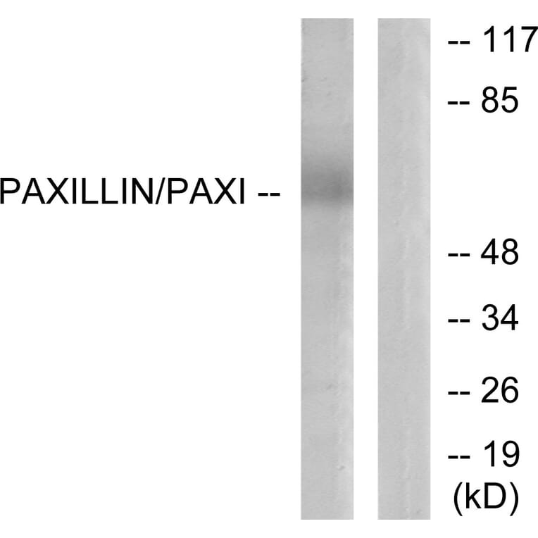 Western Blot - Anti-Paxillin Antibody (B7192) - Antibodies.com
