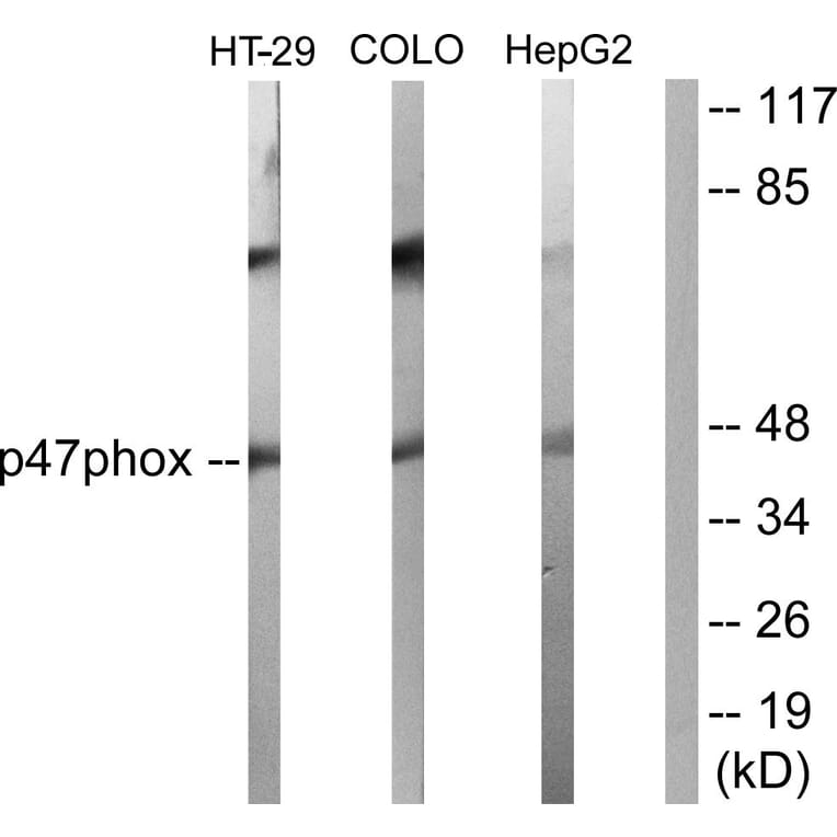 Western Blot - Anti-p47 phox Antibody (B1171) - Antibodies.com