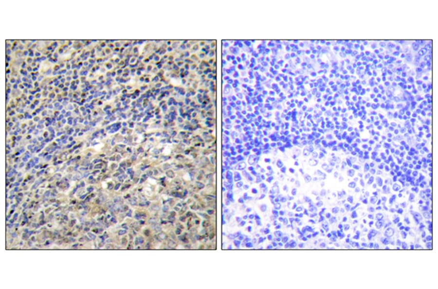 Immunohistochemistry - Anti-p47 phox Antibody (B1171) - Antibodies.com