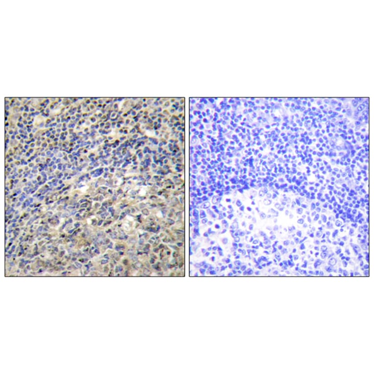 Immunohistochemistry - Anti-p47 phox Antibody (B1171) - Antibodies.com