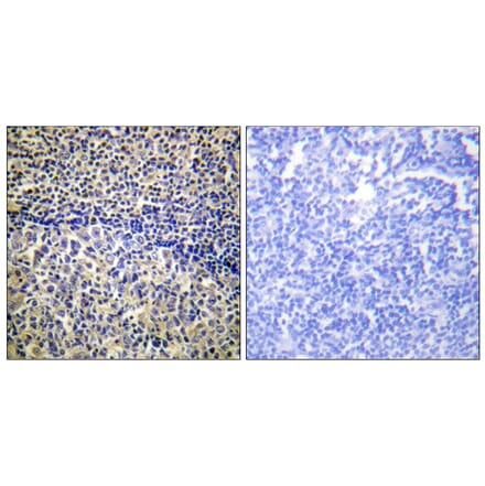 Immunohistochemistry - Anti-p47 phox Antibody (B1161) - Antibodies.com