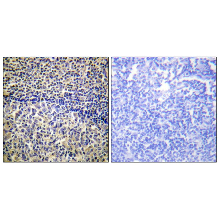 Immunohistochemistry - Anti-p47 phox Antibody (B1161) - Antibodies.com