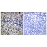 Immunohistochemistry - Anti-p47 phox Antibody (B1161) - Antibodies.com