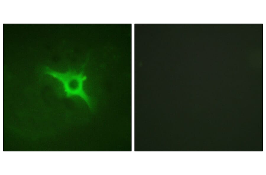 Immunofluorescence - Anti-p47 phox Antibody (B1161) - Antibodies.com