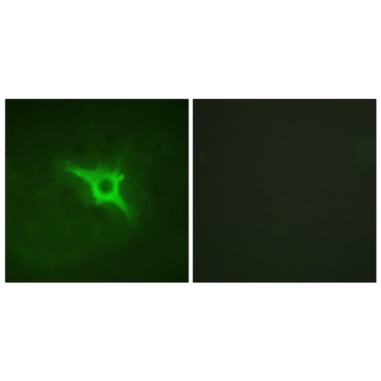 Immunofluorescence - Anti-p47 phox Antibody (B1161) - Antibodies.com