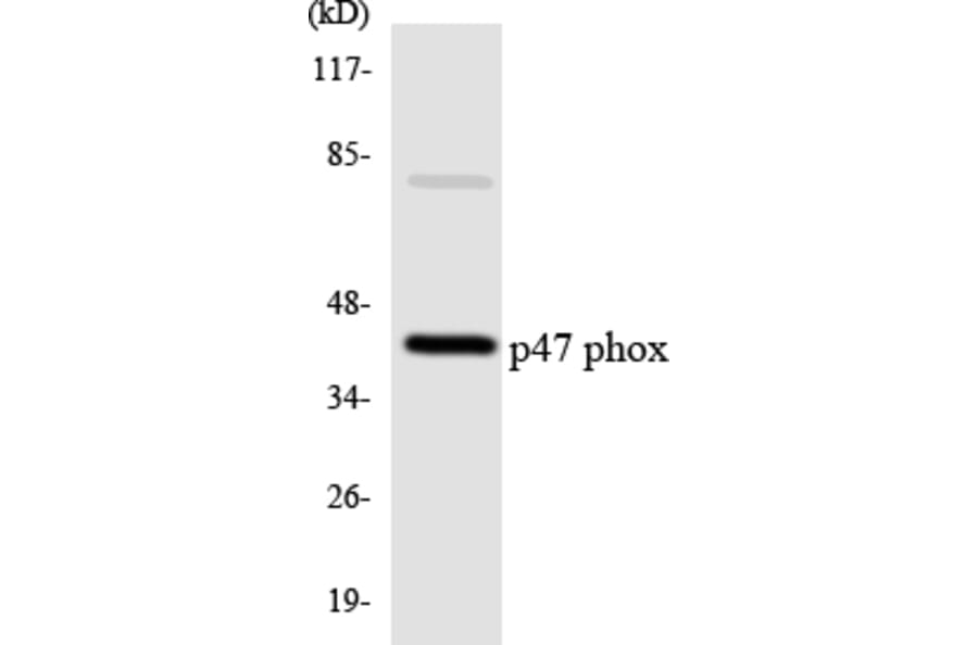 Western Blot - Anti-p47 phox Antibody (R12-3284) - Antibodies.com