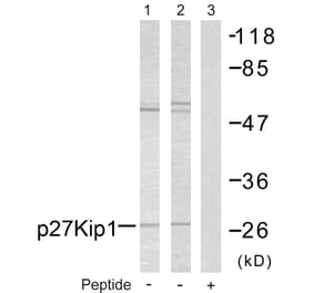 Western Blot - Anti-p27 Kip1 Antibody (B7176) - Antibodies.com