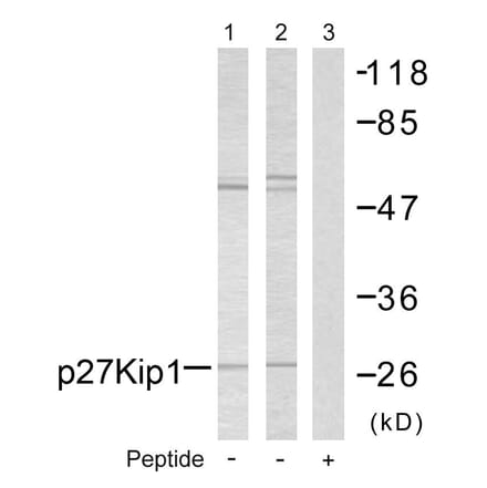 Western Blot - Anti-p27 Kip1 Antibody (B7176) - Antibodies.com