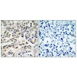 Immunohistochemistry - Anti-p27 Kip1 Antibody (B7176) - Antibodies.com