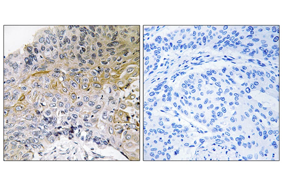 Immunohistochemistry - Anti-p130 Cas Antibody (B0077) - Antibodies.com