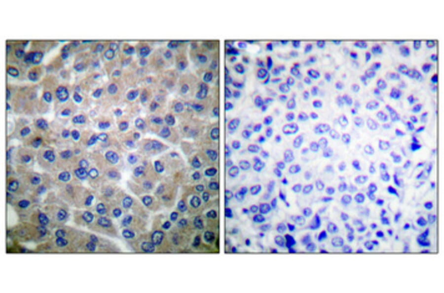Immunohistochemistry - Anti-p130 Cas Antibody (B0077) - Antibodies.com