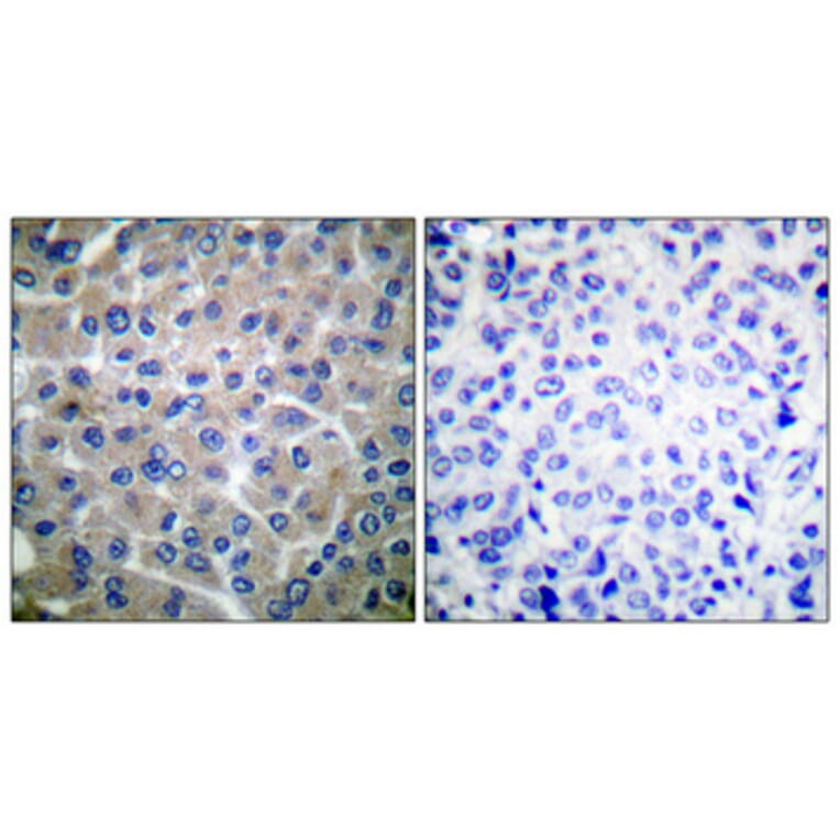 Immunohistochemistry - Anti-p130 Cas Antibody (B0077) - Antibodies.com
