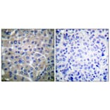 Immunohistochemistry - Anti-p130 Cas Antibody (B0077) - Antibodies.com