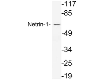 Western Blot - Anti-Netrin-1 Antibody (R12-2256) - Antibodies.com