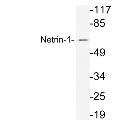 Western Blot - Anti-Netrin-1 Antibody (R12-2256) - Antibodies.com