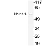 Western Blot - Anti-Netrin-1 Antibody (R12-2256) - Antibodies.com