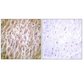 Immunohistochemistry - Anti-MAPKAPK2 Antibody (B0677) - Antibodies.com