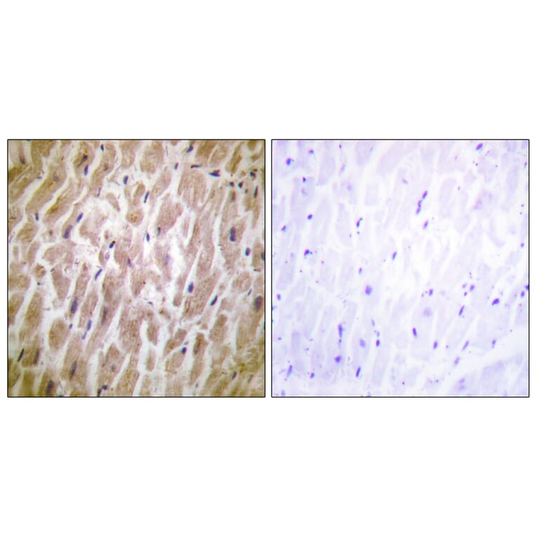 Immunohistochemistry - Anti-MAPKAPK2 Antibody (B0677) - Antibodies.com