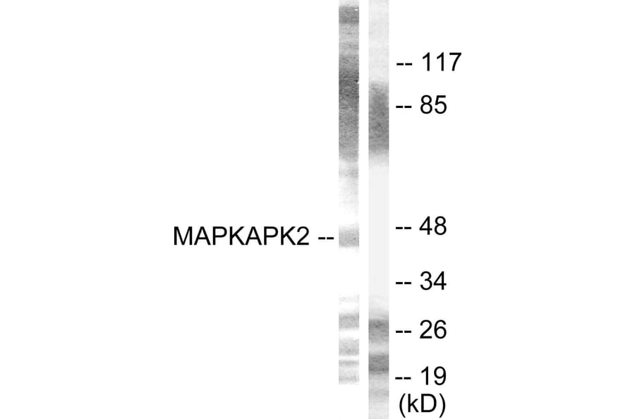 Western Blot - Anti-MAPKAPK2 Antibody (B0018) - Antibodies.com