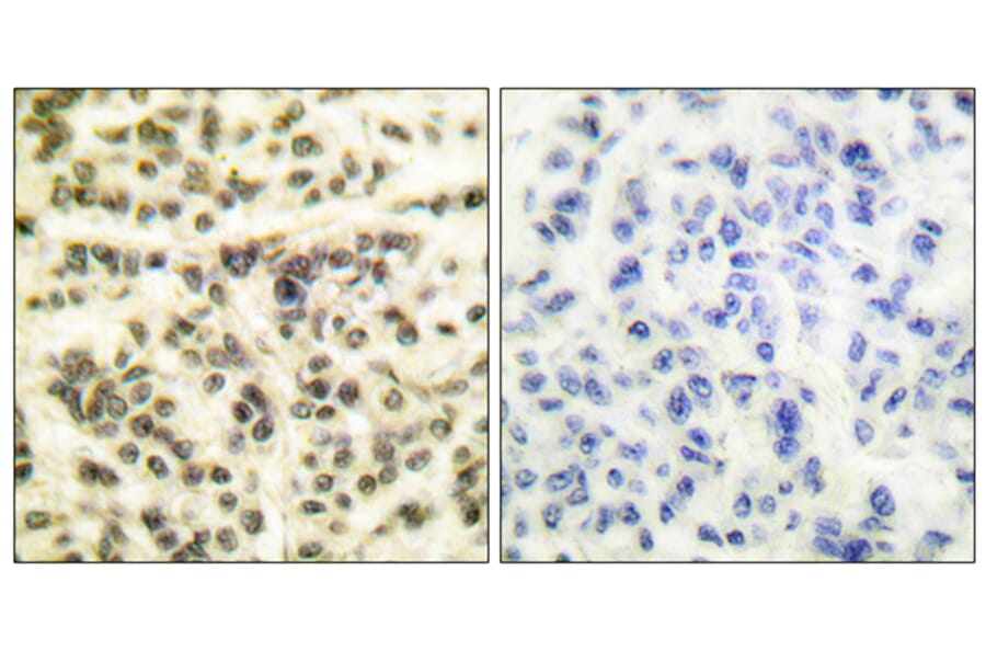 Immunohistochemistry - Anti-MAPKAPK2 Antibody (B0018) - Antibodies.com