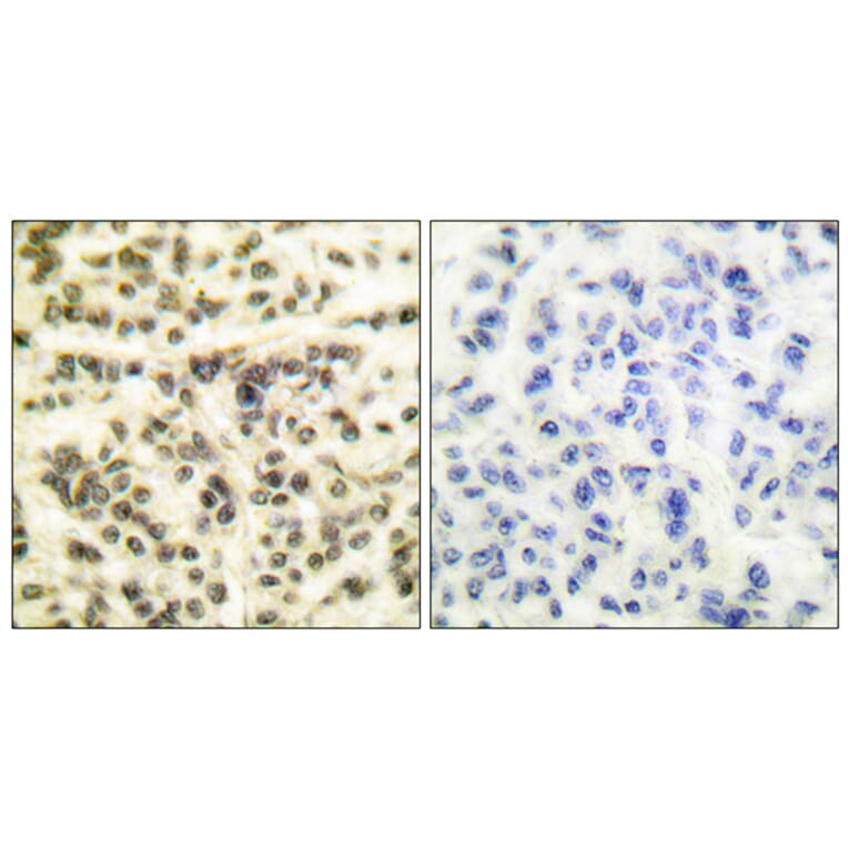 Immunohistochemistry - Anti-MAPKAPK2 Antibody (B0018) - Antibodies.com