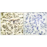 Immunohistochemistry - Anti-MAPKAPK2 Antibody (B0018) - Antibodies.com