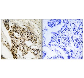 Immunohistochemistry - Anti-MAPKAPK2 Antibody (B8363) - Antibodies.com