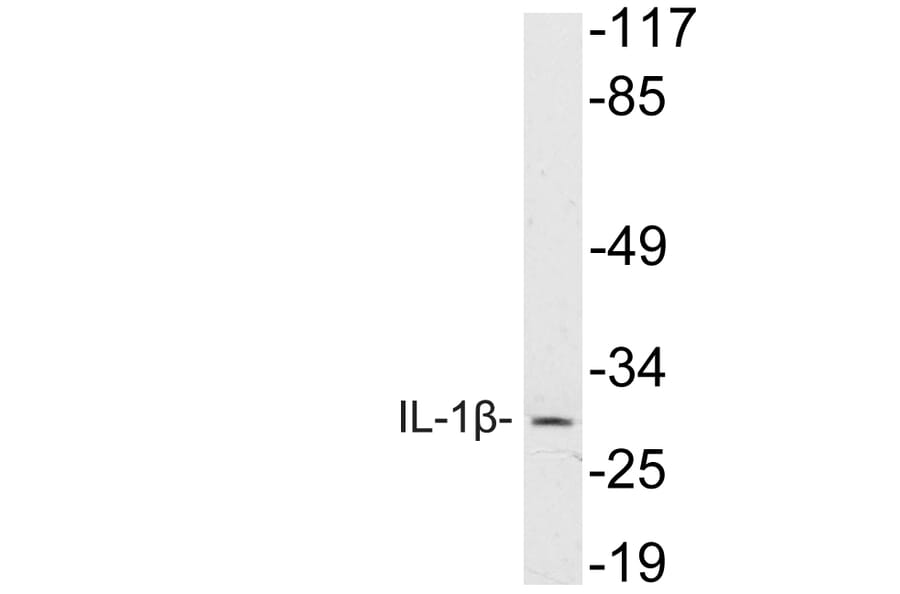 Western Blot - Anti-IL-1beta Antibody (R12-2204) - Antibodies.com