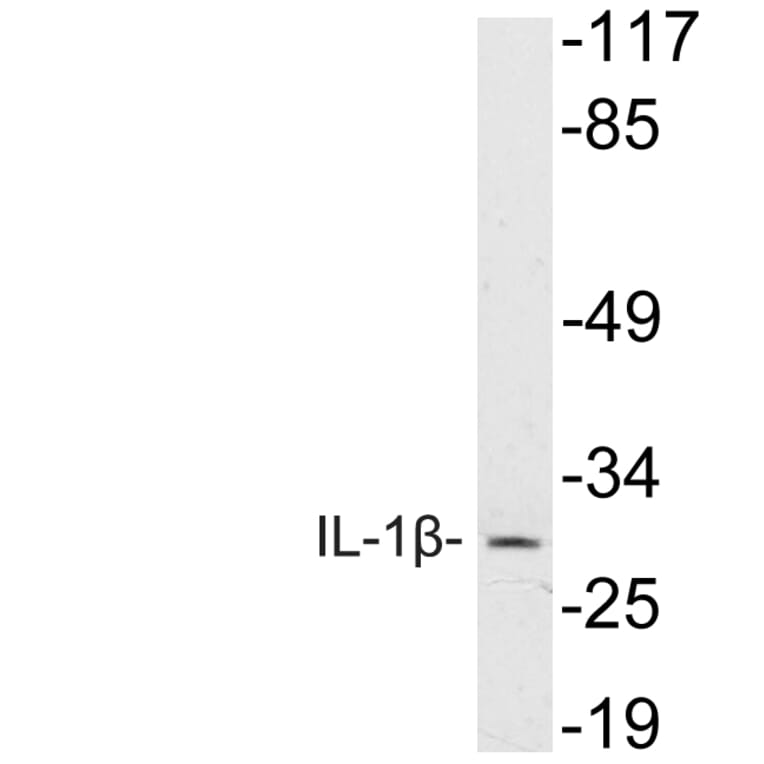 Western Blot - Anti-IL-1beta Antibody (R12-2204) - Antibodies.com