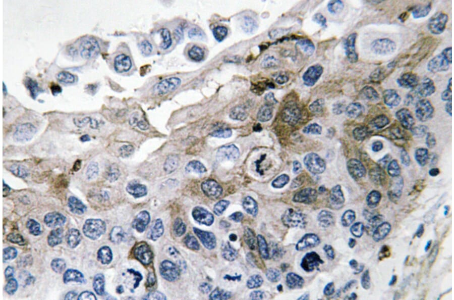Immunohistochemistry - Anti-IL-1beta Antibody (R12-2204) - Antibodies.com